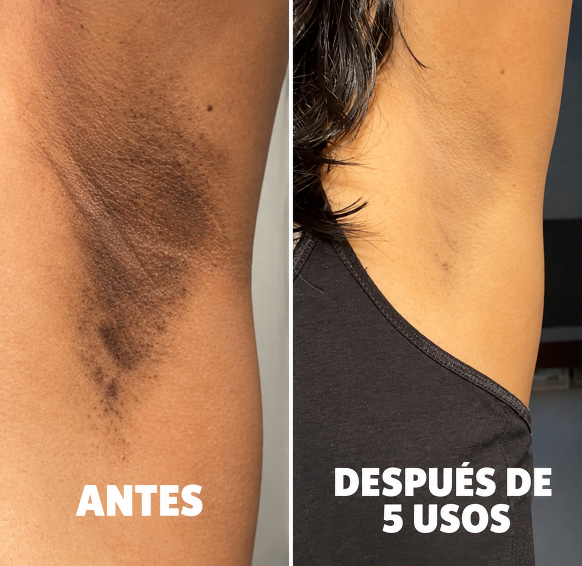 Axila antes y después de 5 usos