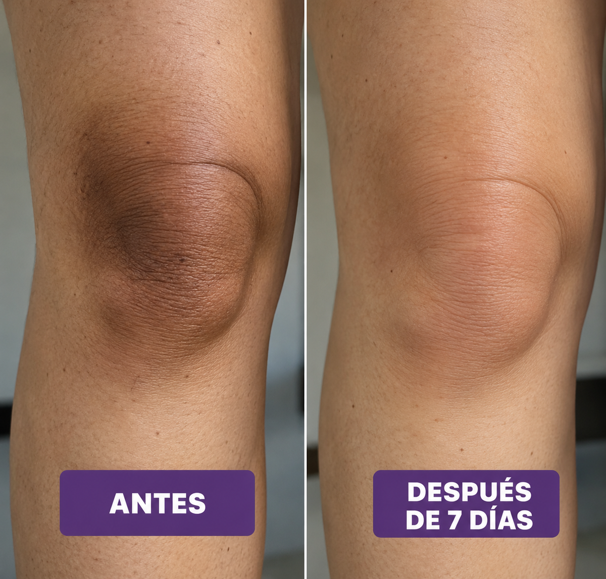 Rodilla antes y después de 7 días